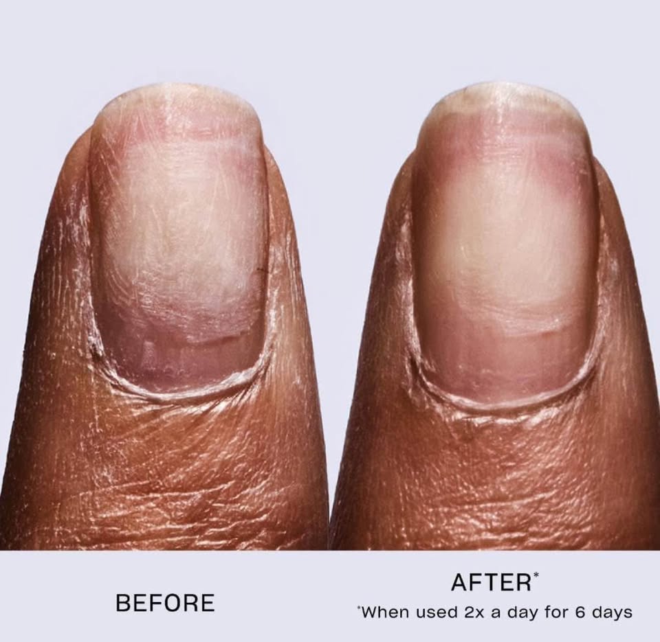 OPI Repair Mode Nail Serum | Keratin Treatment - photo 4