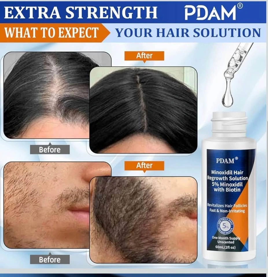 Minoxidil 5% Hair Growth Serum for Men and Women - photo 5