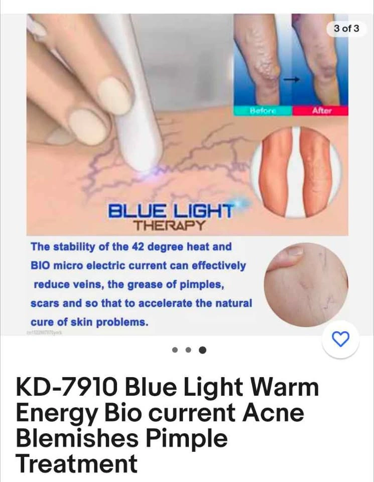 Acne Lazer Blue Light - photo 5