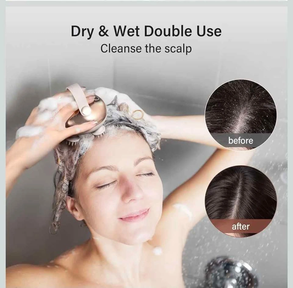 arboleaf Rechargeable Scalp Brush & Stress Reliever - photo 4