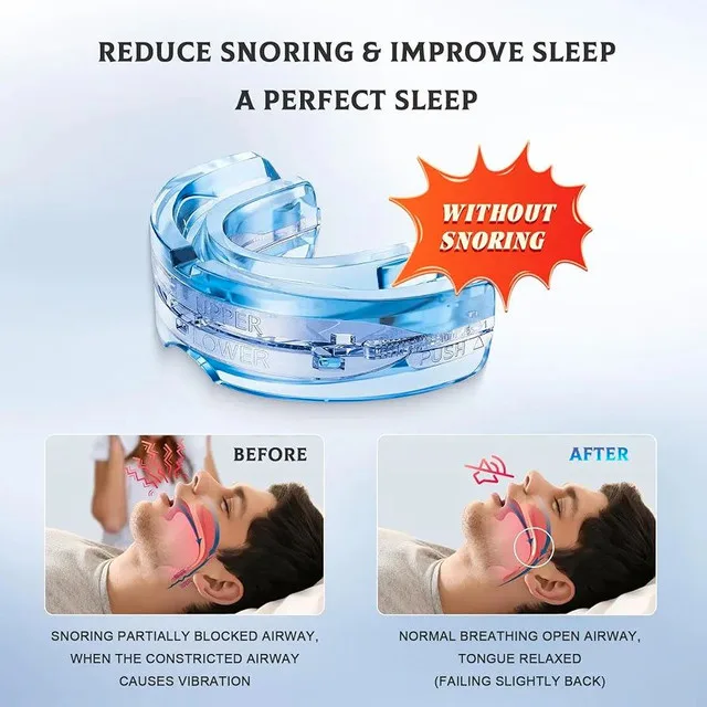Stop Snoring Devices – Anti Snoring Mouth Guard image indicator(7)