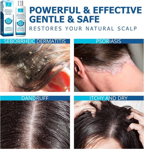 RoyceDerm Seborrheic Dermatitis & Psoriasis Shampoo 250mL - photo 5
