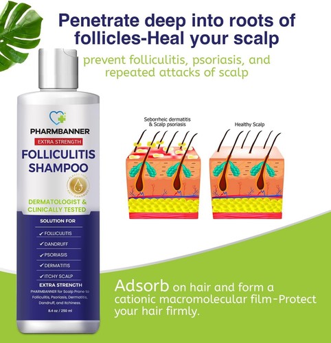 TAGRID Anti-Fungal Shampoo 300mL – Scalp Treatment - photo 3