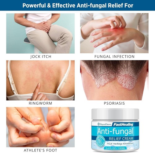 Roycederm Antifungal Cream, Athletes Foot Treatment Cream - photo 3