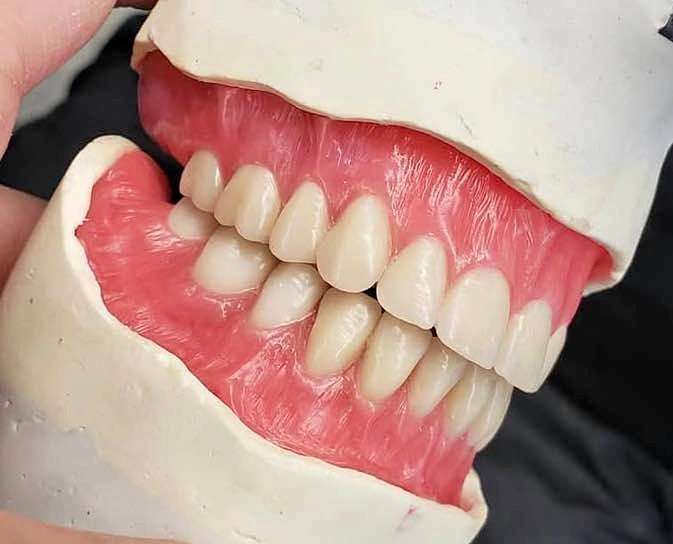 Dentures