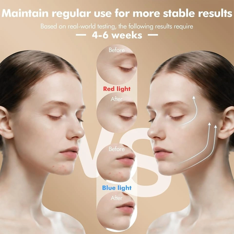 Wireless 4D Red Blue infrared Led Facial Mask - photo 2