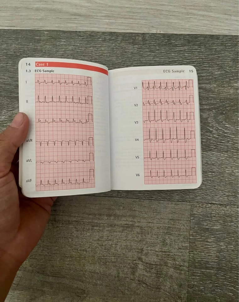 ECG cases pocket book - photo 2