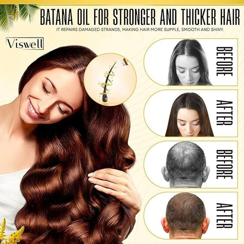 Batana Oil Hair Growth - 5 fl oz, 100% Pure & Natural