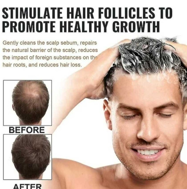 eelhoe ROOT ACTIVATING SHAMPOO - photo 3
