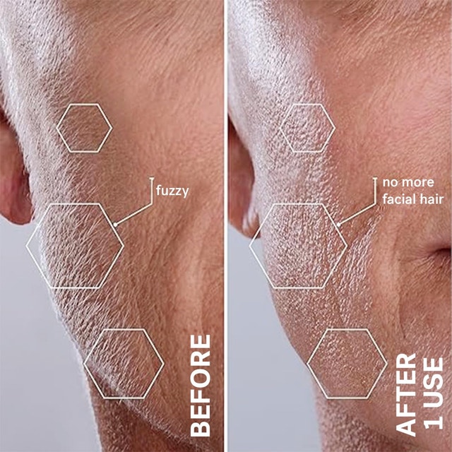 Sonicsmooth Pro+ Hair Removal System - photo 4