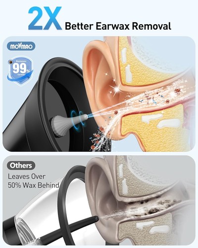 Electric Ear Wax Removal Kit with LED Display & 12 Tips - photo 2