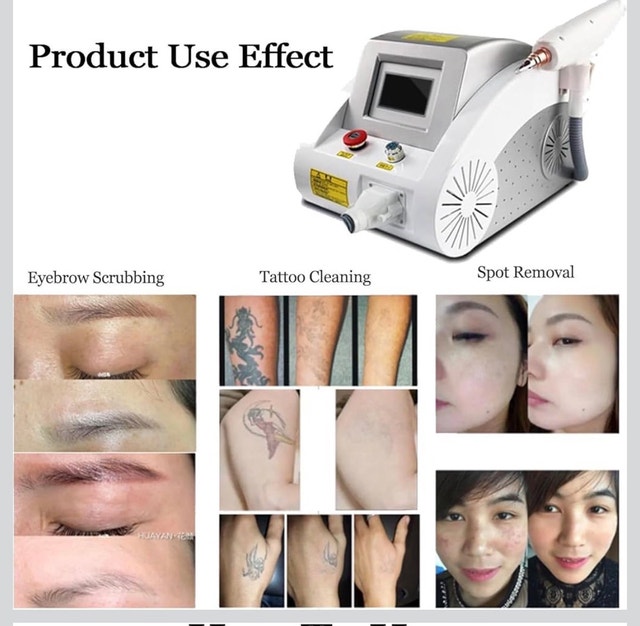 Laser Tattoo Removal Machine! - photo 2
