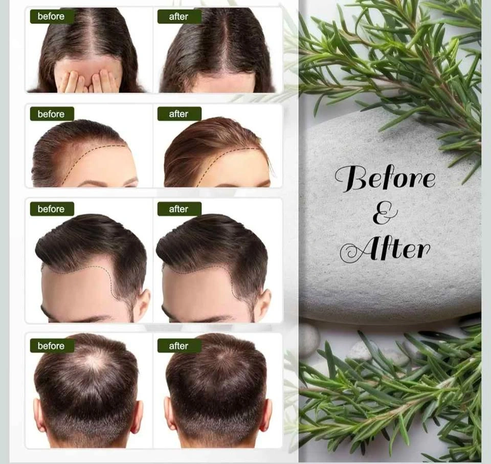 Brand New | Rosemary hair oil kit (30ml) - photo 5