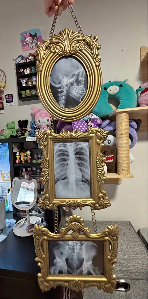 skeleton x-ray decorative frames