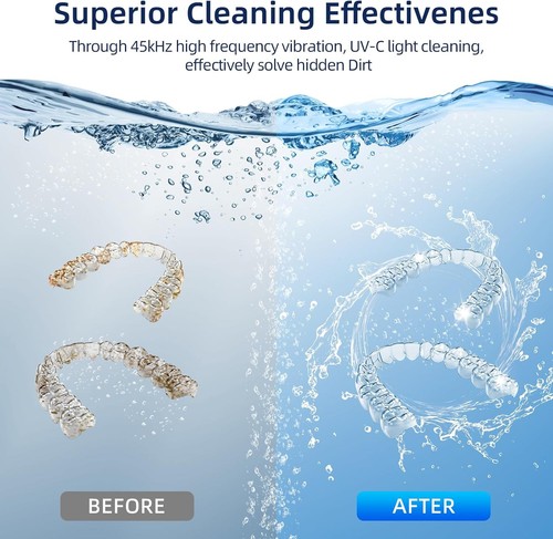 Dental Ultrasonic Retainer Cleaner Machine - photo 5