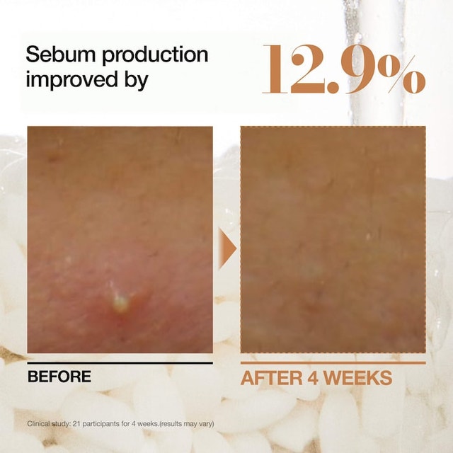 Anua Rice 70 Milky Toner - photo 3