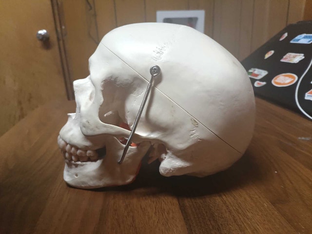 A24 Functional TMJ Human Skull Model with Mastication Muscles - photo 3