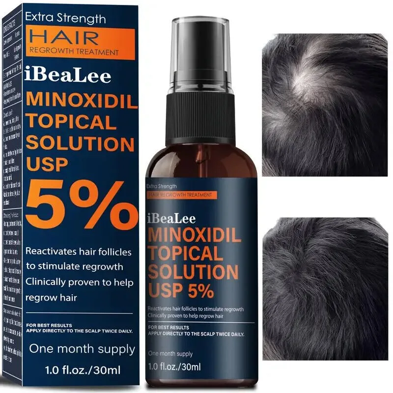 5 % Minoxidil Hair Growth Spray CLINICALLY PROVEN 🧡Buy3,G1free!! image indicator(2)