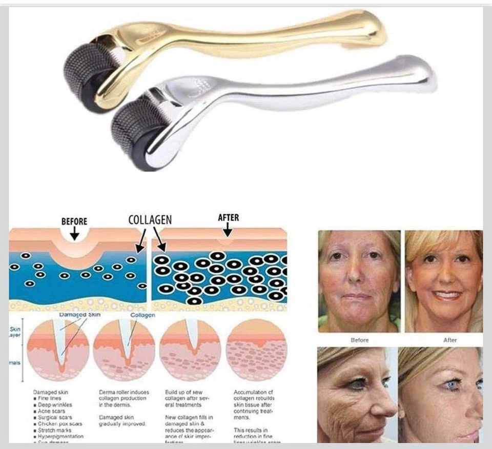 Derma Roller 1.00mm Microneedle Skin Care Tool New - photo 2