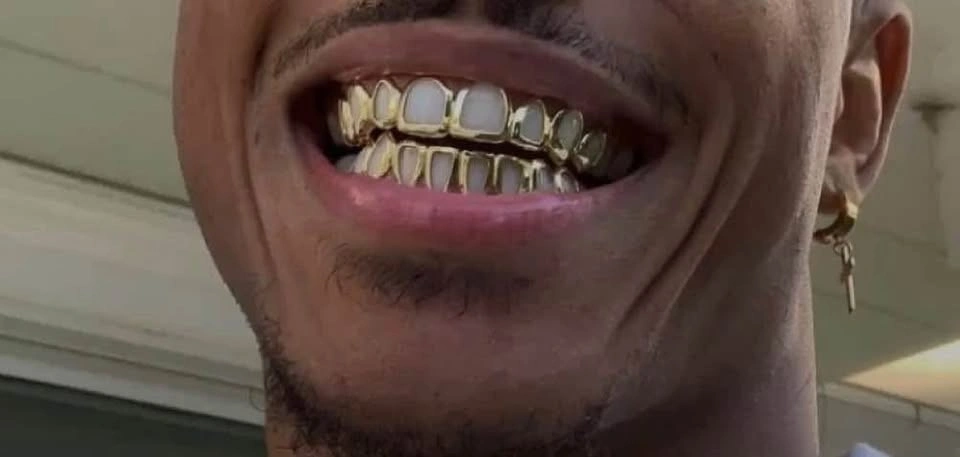 Custom Grillz (free consultation)