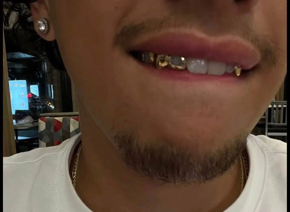 Custom Grillz (free consultation) - photo 2