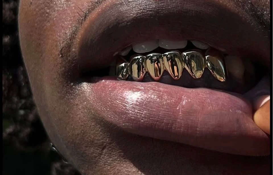 Custom Grillz (free consultation) - photo 3