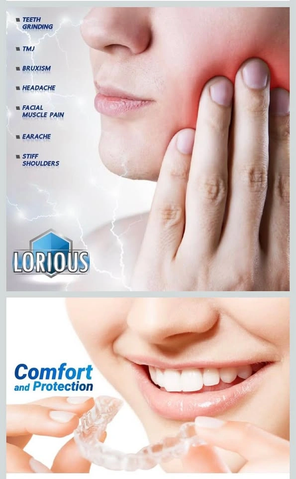 Moldable mouth guard from teeth grinding - photo 4