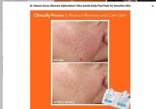 10- Dr Dennis Gross Alpha Beta Ultra Gentle Peels - photo 3