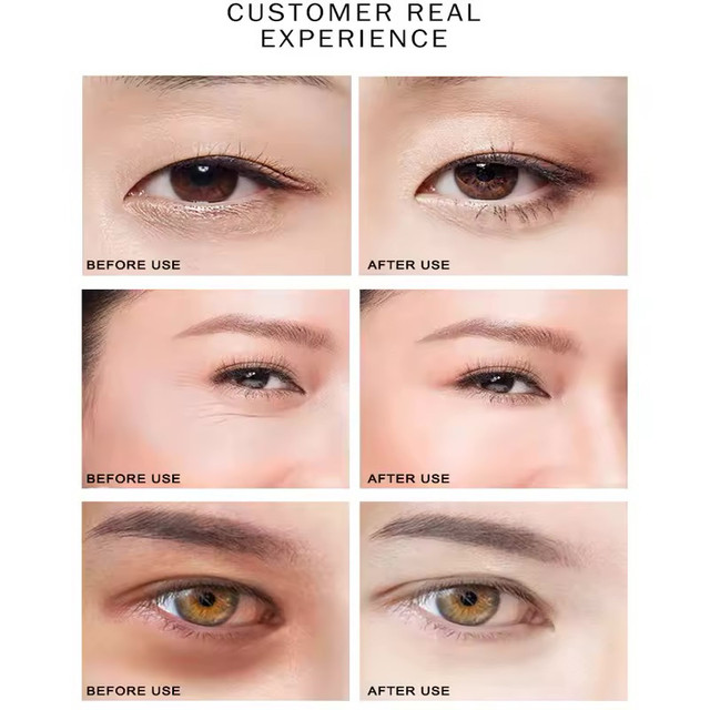 Artiscare: Hyaluronic Acid - Eye Hydrating Mask - photo 5