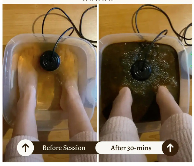 HealifeCo Ionic Foot Spa - photo 4