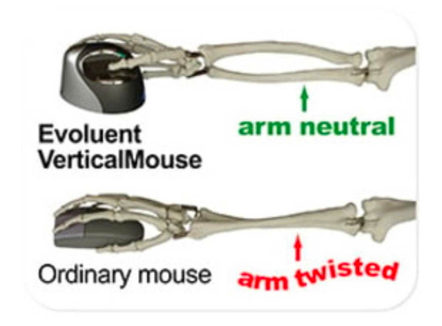 Evoluent Vertical Mouse - photo 2