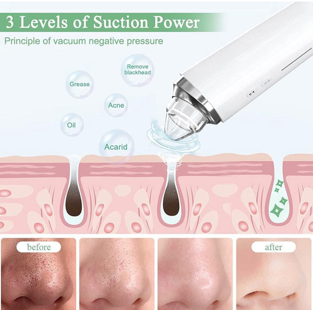 Blackhead Remover! Green - photo 4