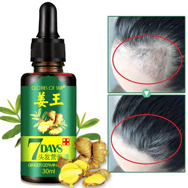 Ginge Oil 7 Days for Fast Hair Growth 6 Nos - photo 2