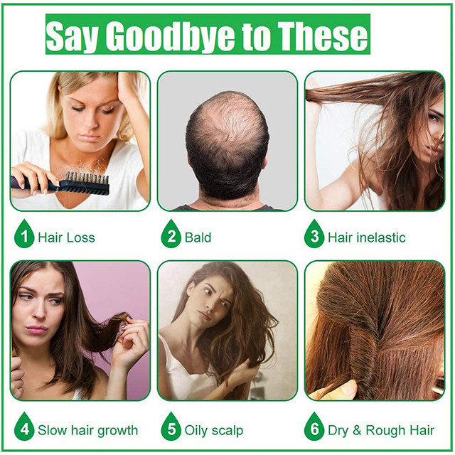 Ginge Oil 7 Days for Fast Hair Growth 6 Nos - photo 5