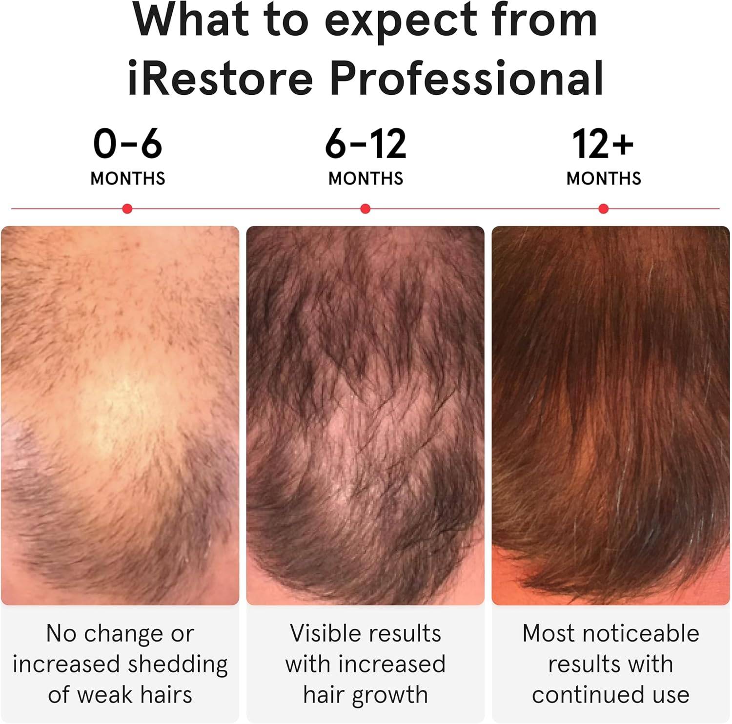 iRestore Professional Laser Hair Growth System-FDA Cleared Laser - photo 4