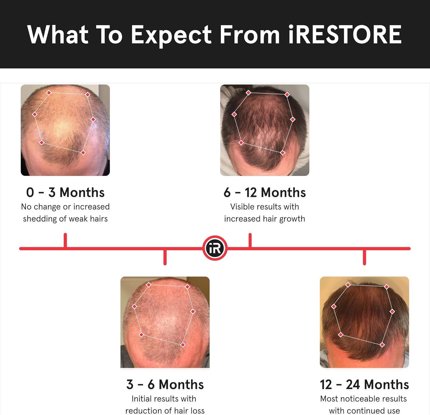 iRestore Essential - Laser Red Light Therapy for Hair Growth - photo 4