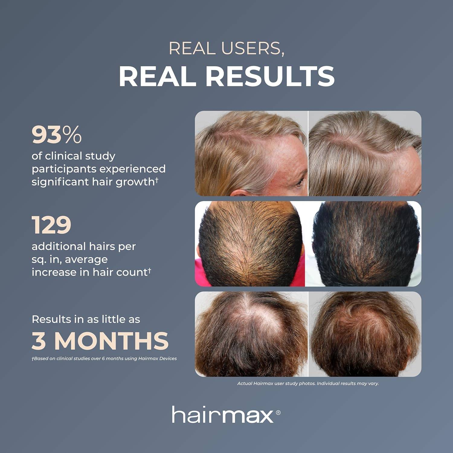 Hairmax Laser Hair Growth Comb Ultima 9 Classic - photo 3