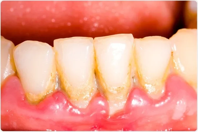 Free dental cleaning - photo 2