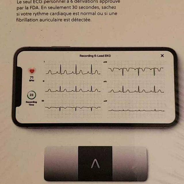 AliveCor KardiaMobile 6L Personal EKG Sensor - photo 2