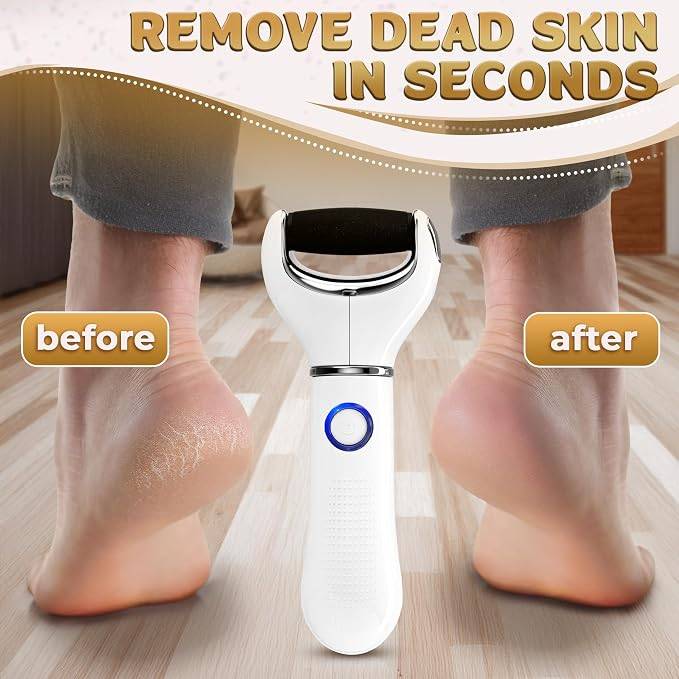 Electric Foot File & Callus Remover - photo 3