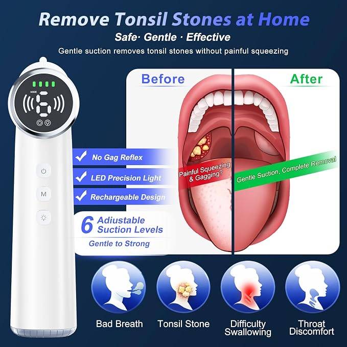 Electric Tonsil Stone Vacuum Remover - photo 3