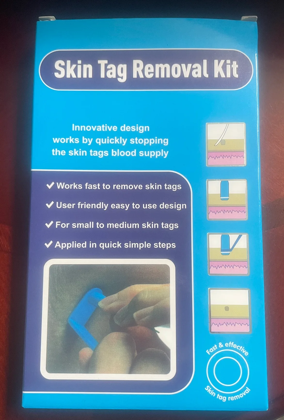 Skin Tag Removal Kit thumbnail