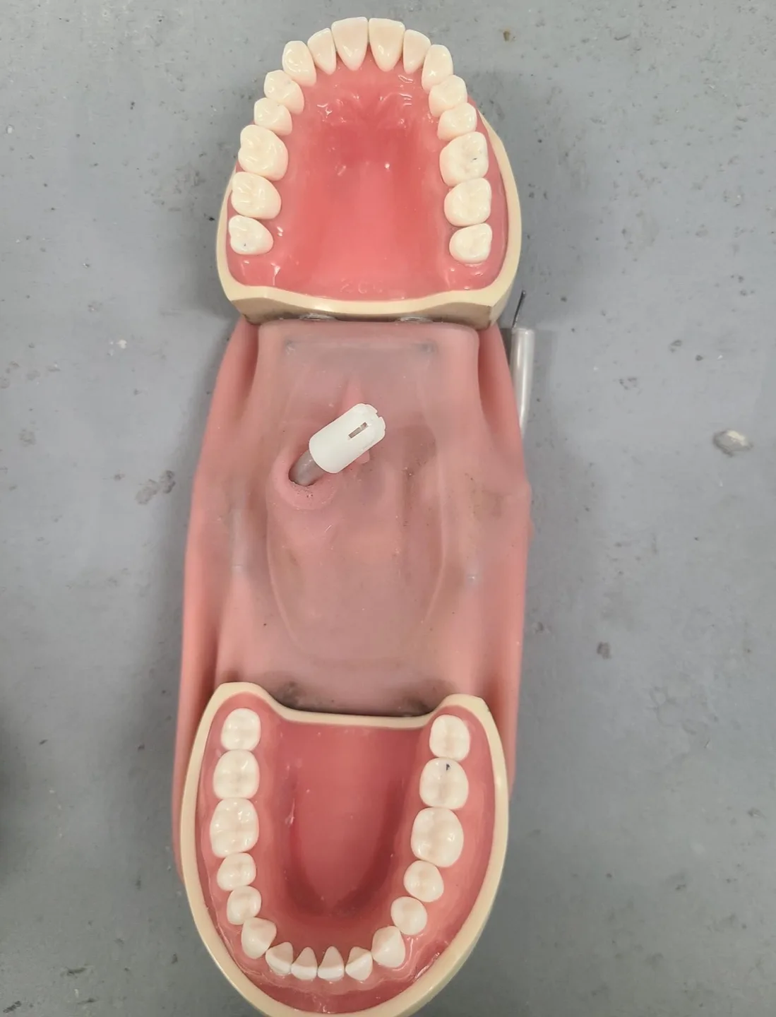 Typodont articulator image indicator(3)