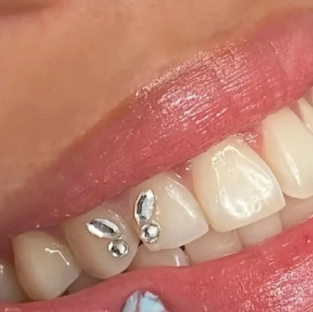 LIGHT GREEN BUTTERFLY DESIGN - Set of tooth gems 💎 image indicator(2)