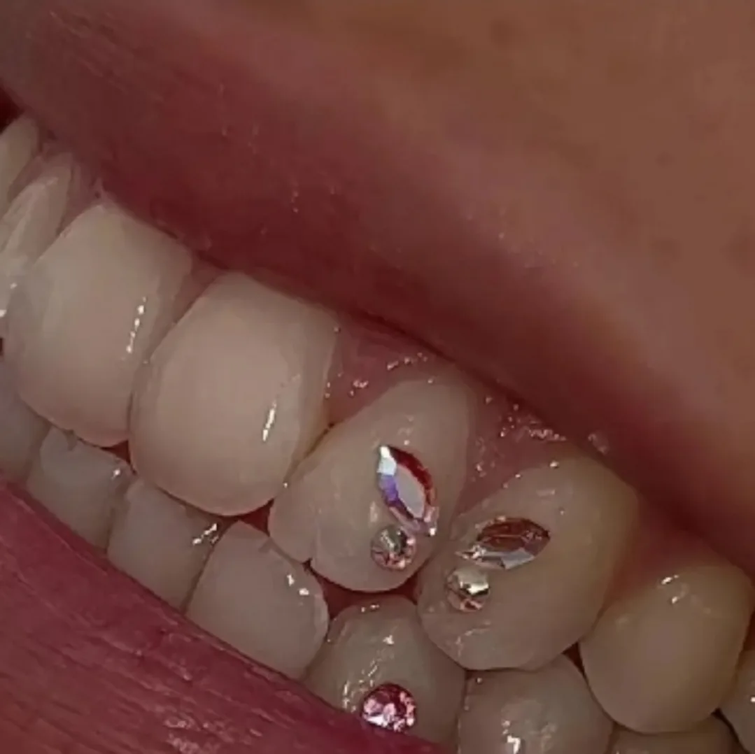 BLUE Butterfly Tooth Gems SET 4 gems 💎 image indicator(2)