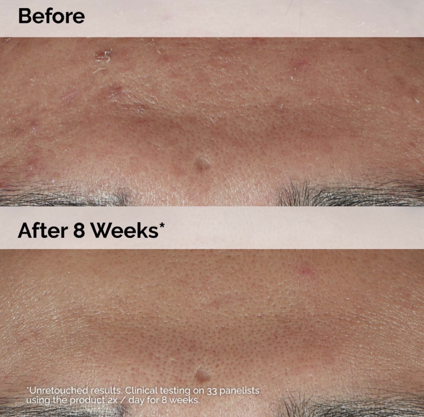The Ordinary Niacinamide 10% + Zinc 1% Serum - photo 3