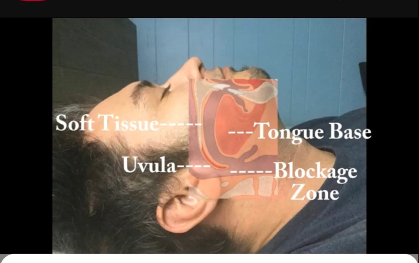 Anti-Snoring Chin Strap - Sleep Aid image indicator(5)