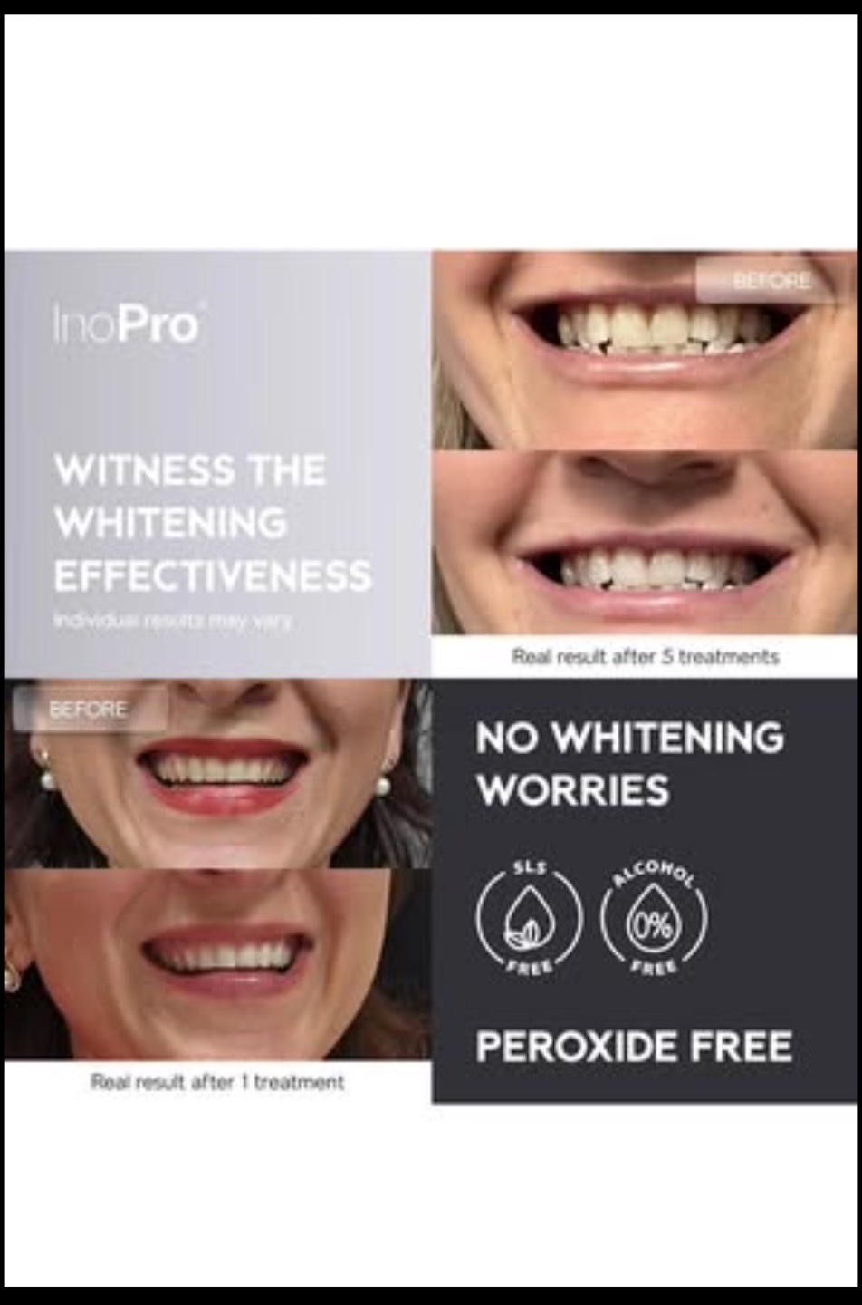 InoPro Whitening Strips - 28 Strips - photo 2