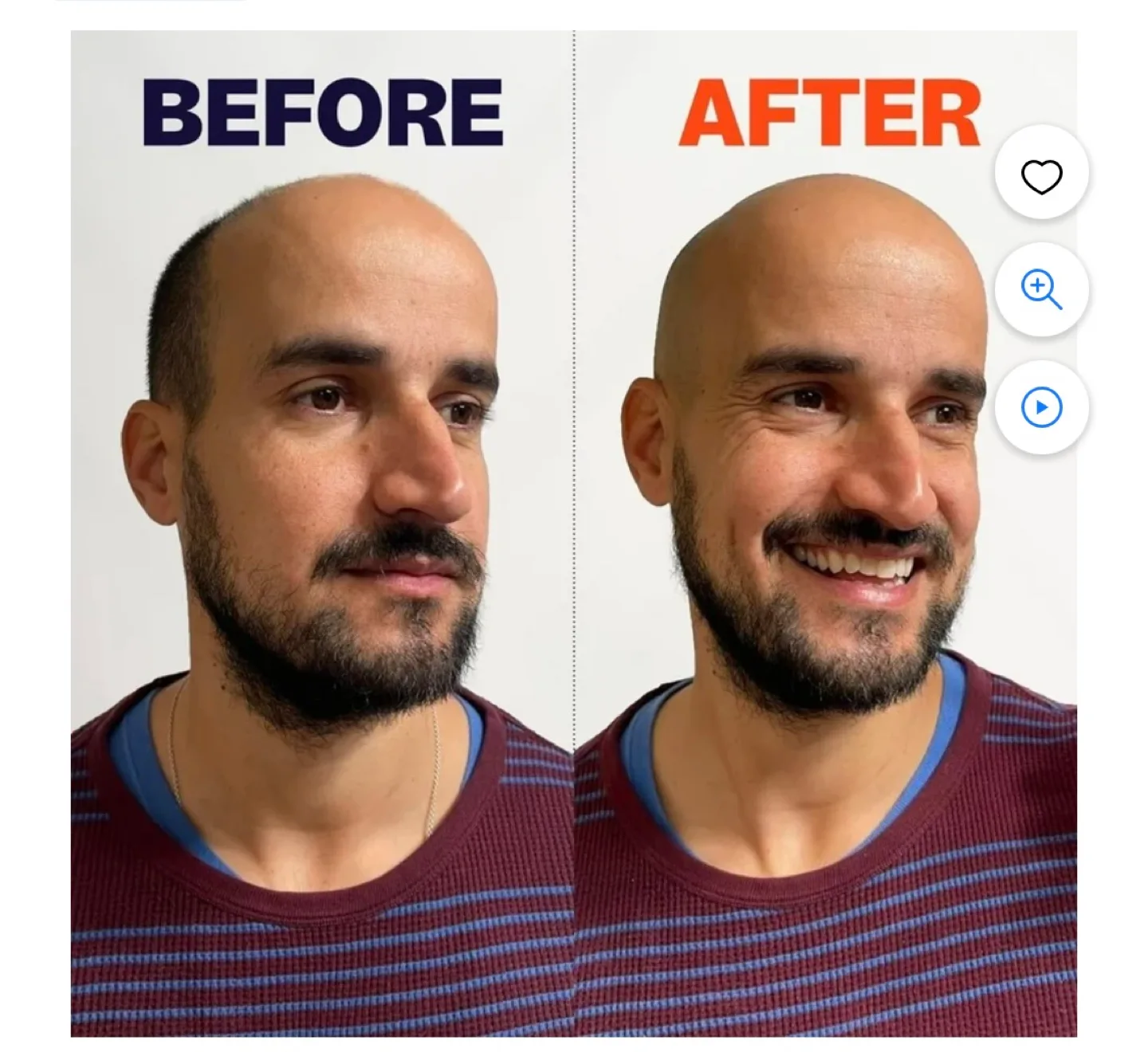 Freebird Flex Series Shaving Kit - Electric Rotary Head Shaver image indicator(5)