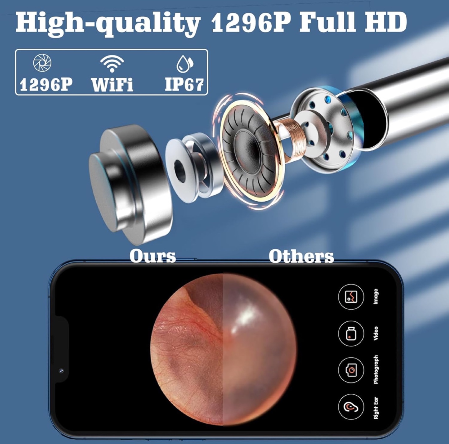 Wireless HD Smart Ear Cleaning Endoscope Camera - photo 5